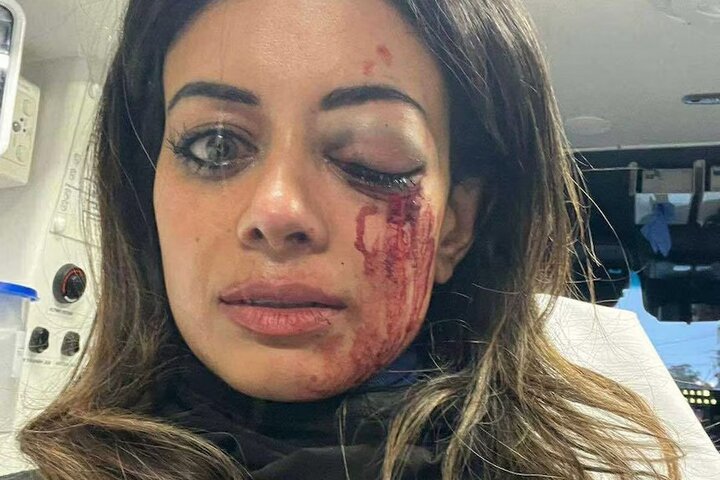 سڈنی میں فلسطین حامی سیاستدان پولیس تشدد کا شکار