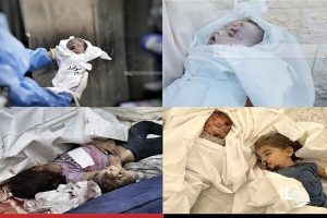 صیہونی غزہ میں غیر انسانی اور نسل کشی کی پالیسی اختیار کیے ہوئے ہیں:عالمی ڈاکٹرز